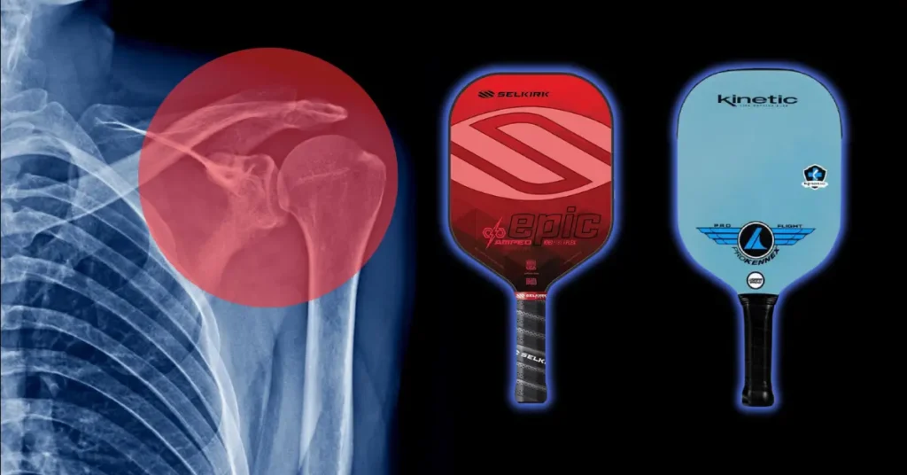 Best Pickleball Paddle for Shoulder Pain